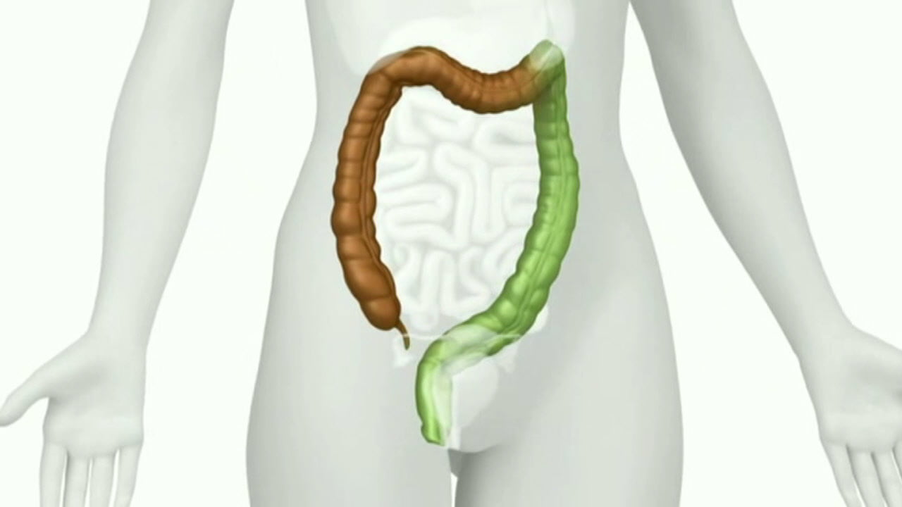 Colon Darmreinigung